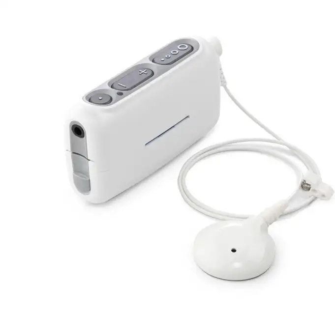 Advanced Bionics Chorus Sound Processor