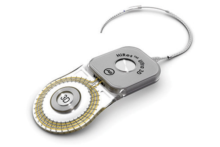 HiRes Ultra 3D Implant