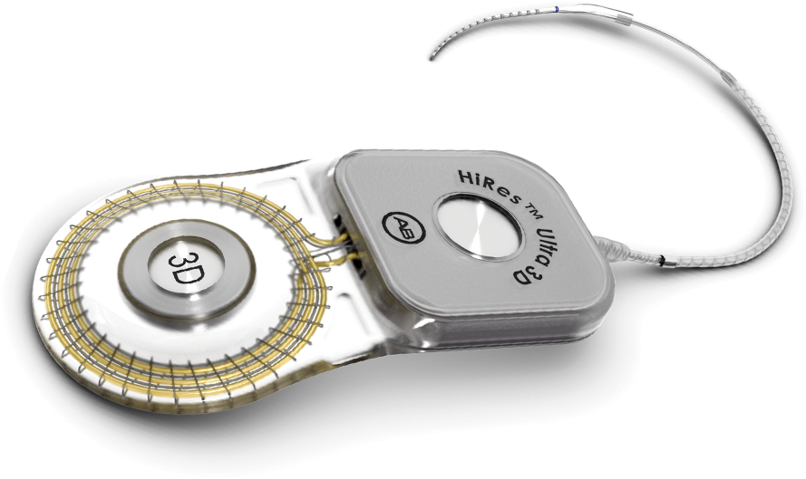 Advanced Bionics HiRes Ultra 3D Cochlear Implant