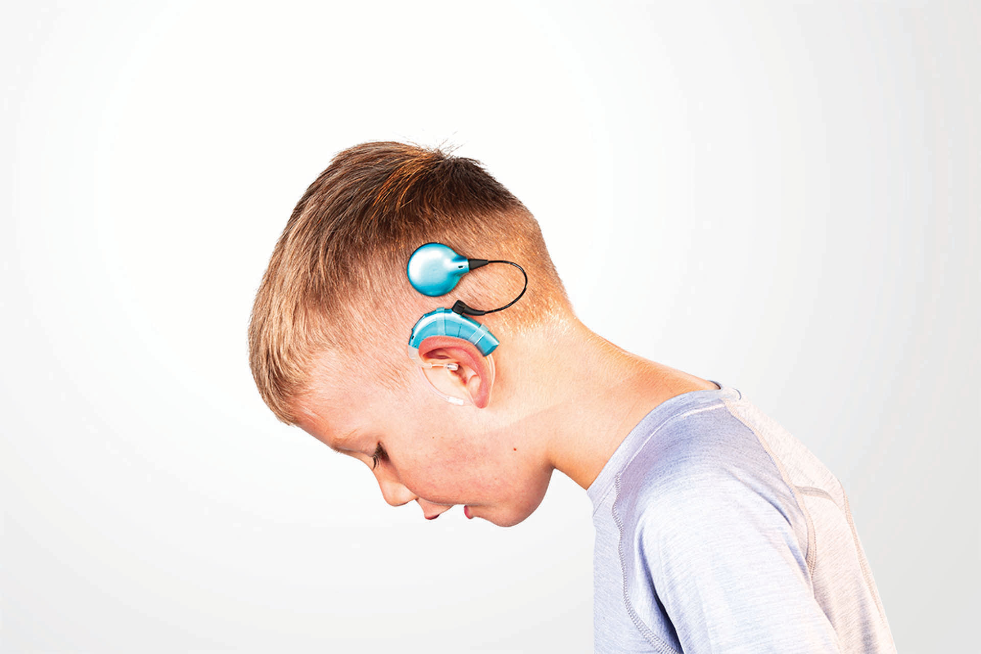 kid wearing cochlear implant held in place with 