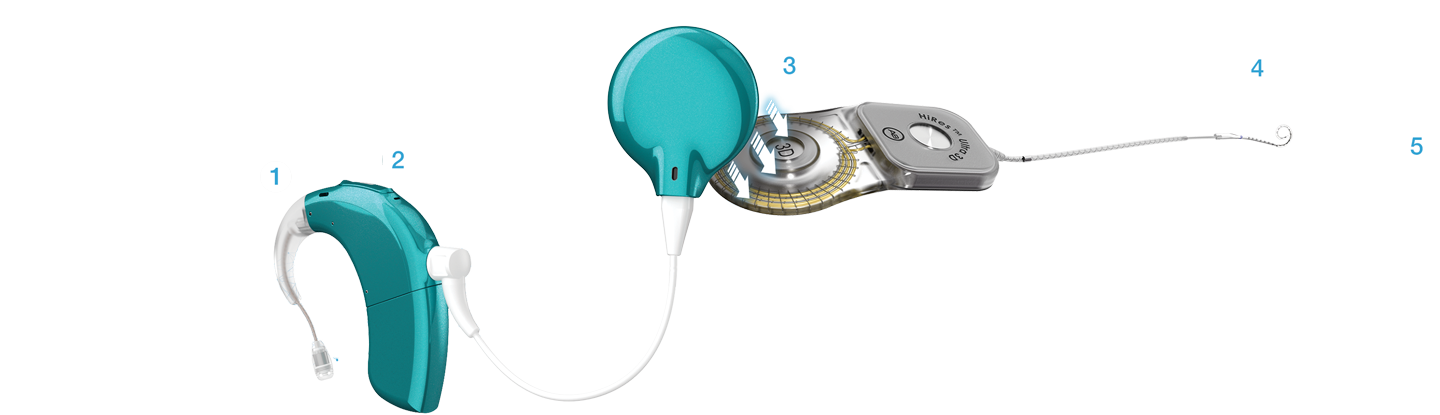 Sky CI M cochlear implant  system